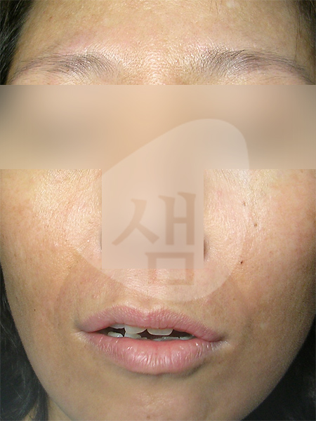 case019a.jpg