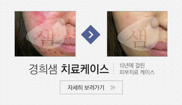 경희샘치료케이스