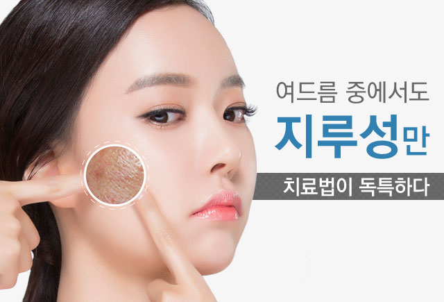 여드름중에서도 지루성만 치료법이 독특하다